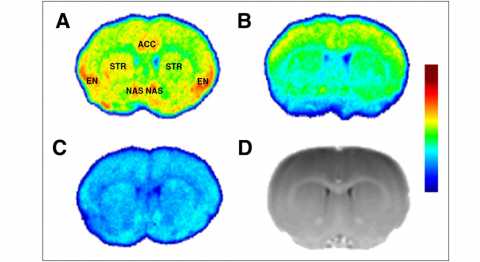 psychiatric brain.png