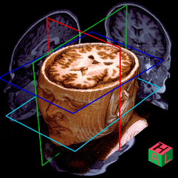 MRI 3D Render MRI 3D Render